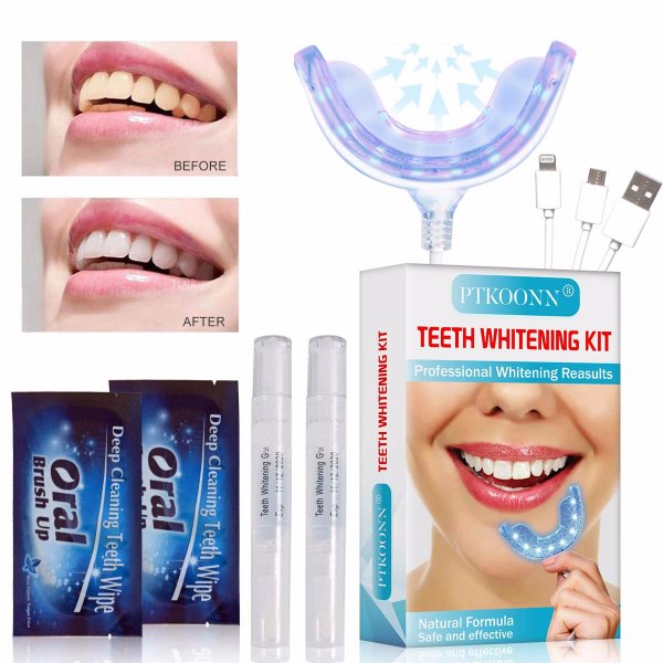 Teeth whitening kit.jpg